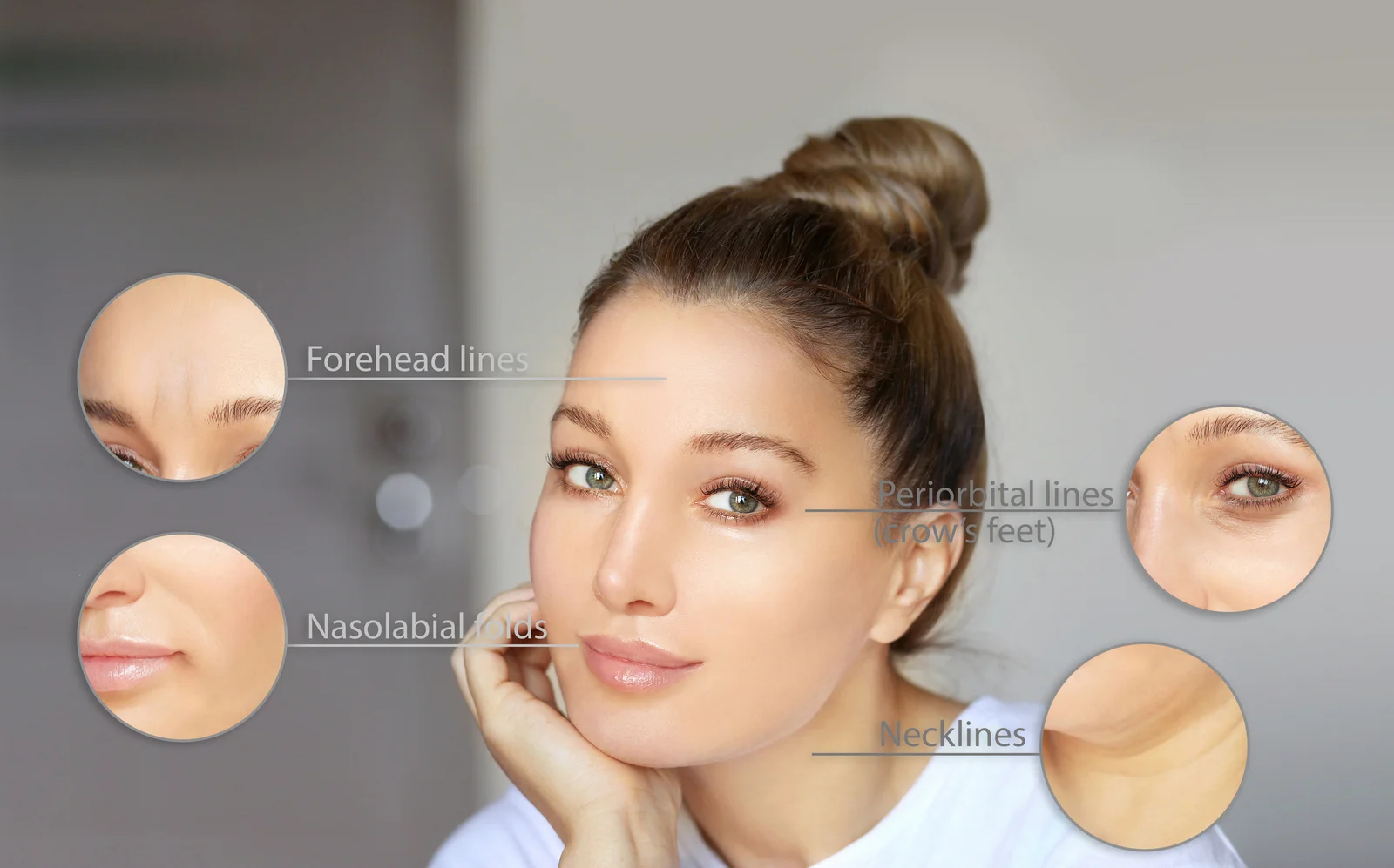 Smile makeover