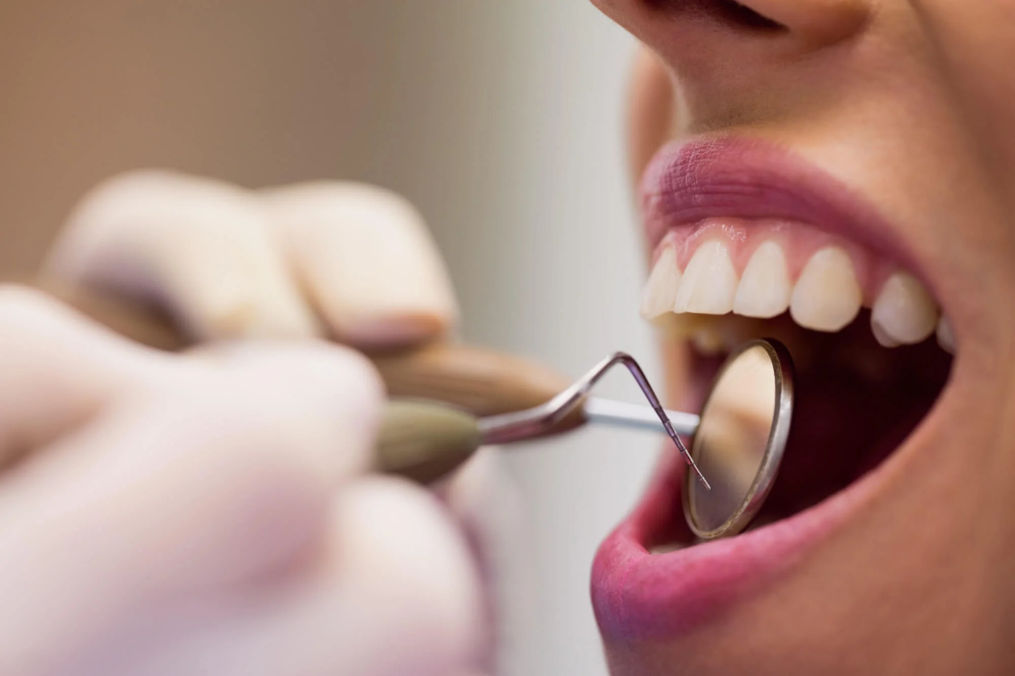 Smile makeover