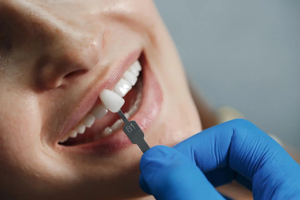 allure-dental (3) General Dentistry