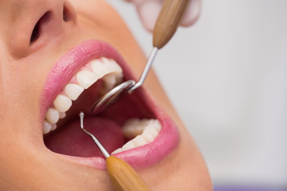allure-dental (9)
