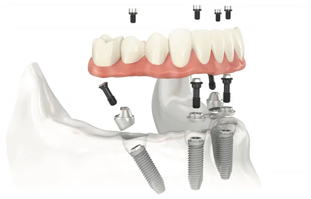 di General Dentistry