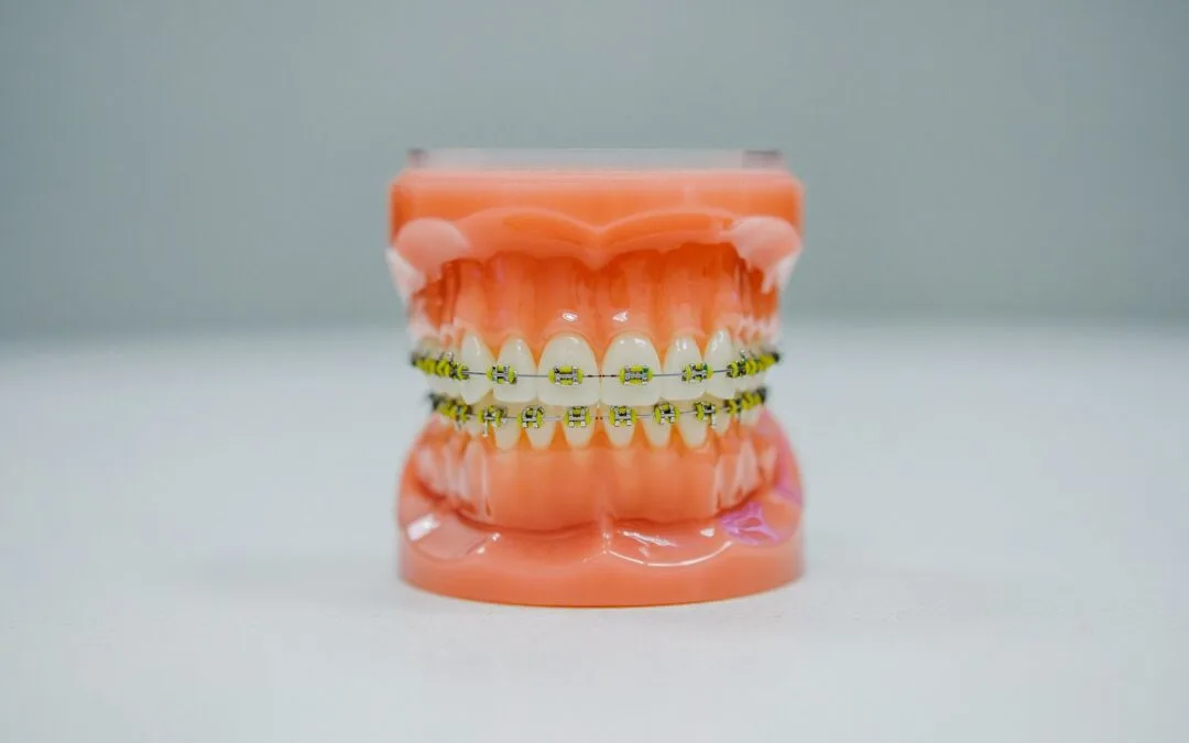 Invisalign in Barnet: Honest Answers to the Questions Patients Are Too Embarrassed to Ask