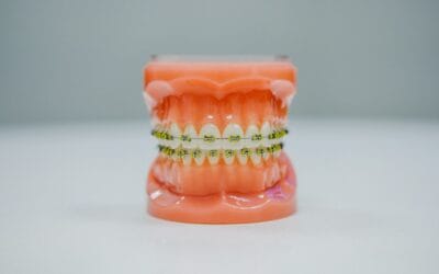 Invisalign in Barnet: Honest Answers to the Questions Patients Are Too Embarrassed to Ask