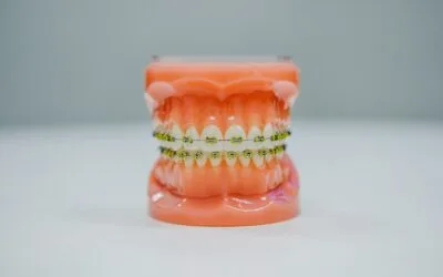 Invisalign in Barnet: Honest Answers to the Questions Patients Are Too Embarrassed to Ask