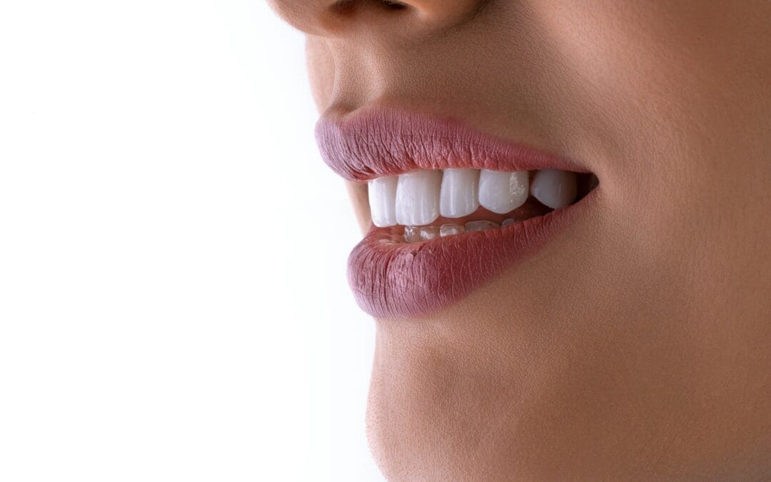 Invisalign in Barnet: What to Expect at Allure Dental Care What to Expect at Allure Dental Care