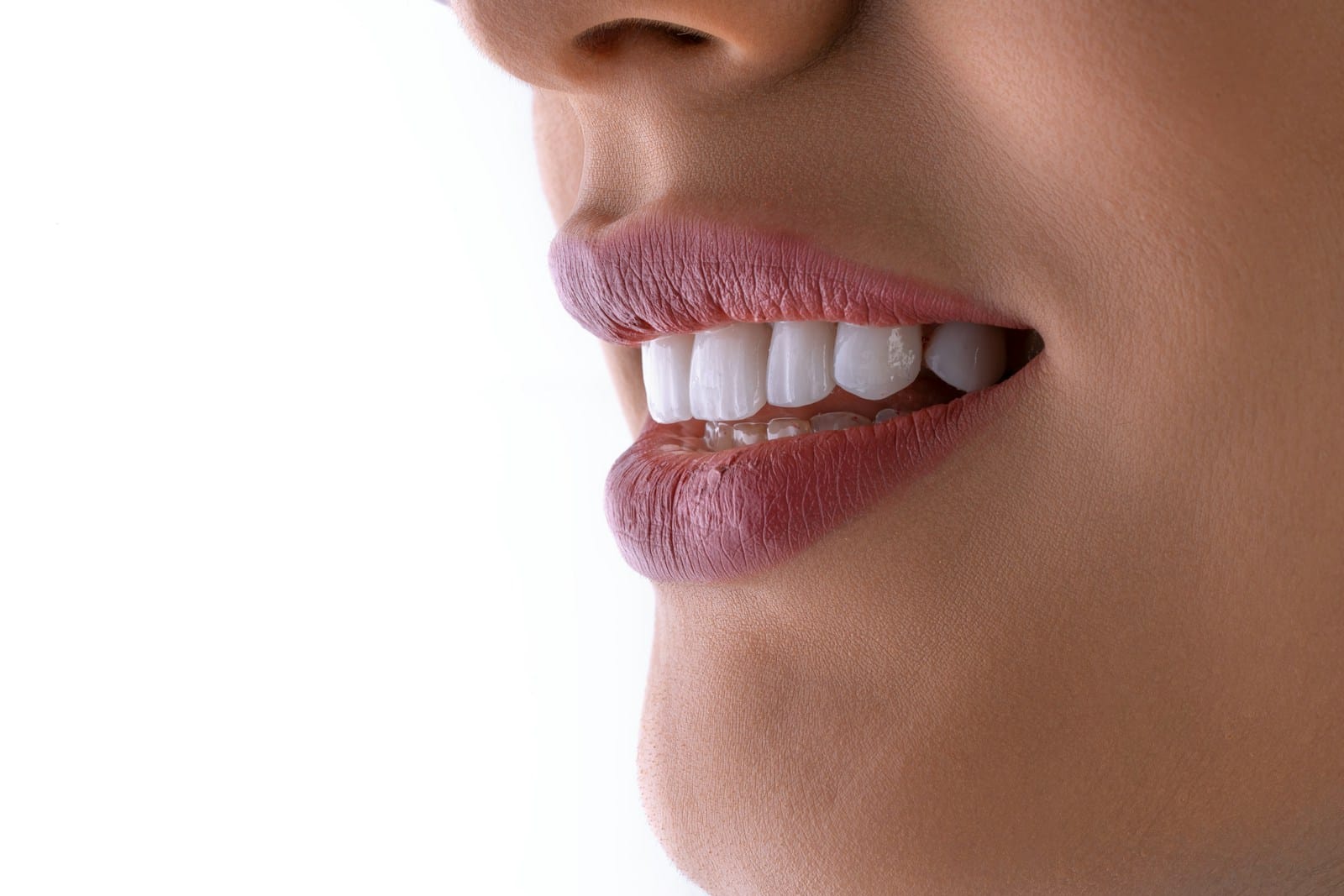 Invisalign in Barnet